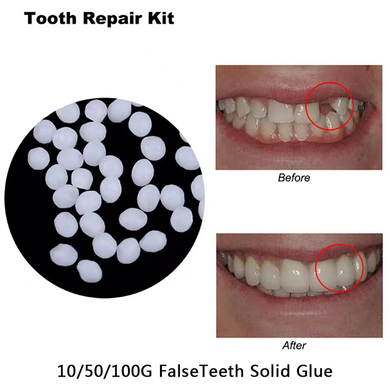 Teeth Whitening Uv Kit - 10g/bag Tooth Repair Kit-thermal Beads For