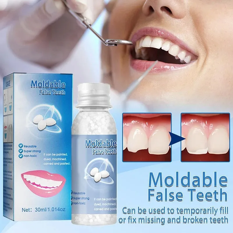 Teeth Whitening Uv Kit - Temporary Tooth Repair Kit Teeth And