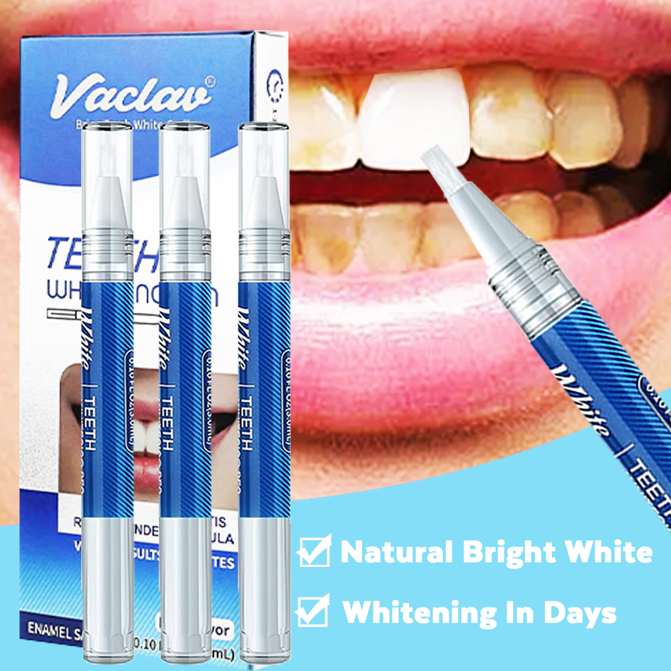 Vaclav Teeth Whitening Pen Too - Whitening Pen Bleach ulasan dan harga