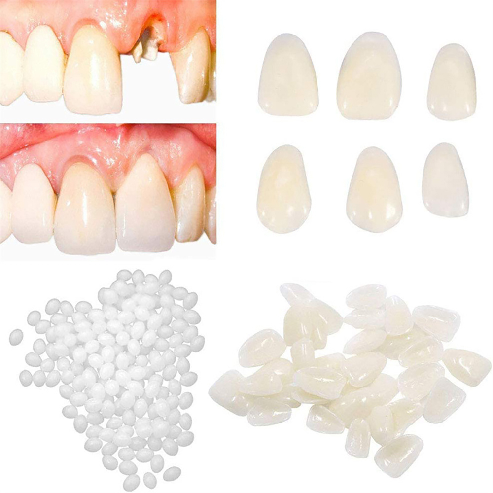 PIORPOY 50/70Pcs Dental Teeth  - Teeth Whitening Uv Kit ulasan dan harga
