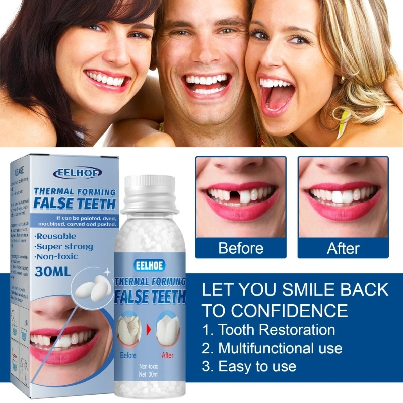 Resin 10ml/20ml/30ml Temporary - Teeth Whitening Uv Kit ulasan dan harga