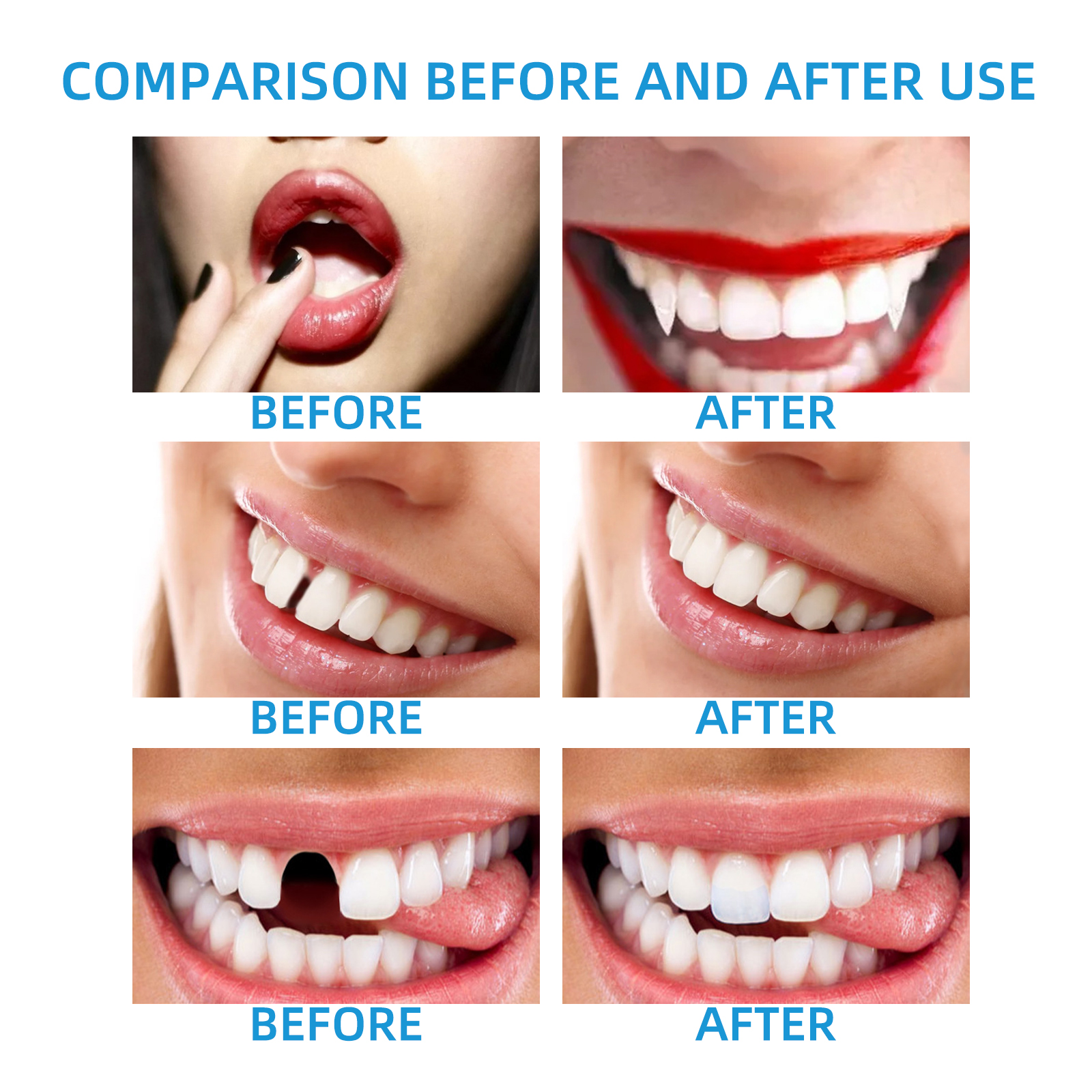 DIY Temporary Tooth Repair Kit - Teeth Whitening Uv Kit ulasan dan harga