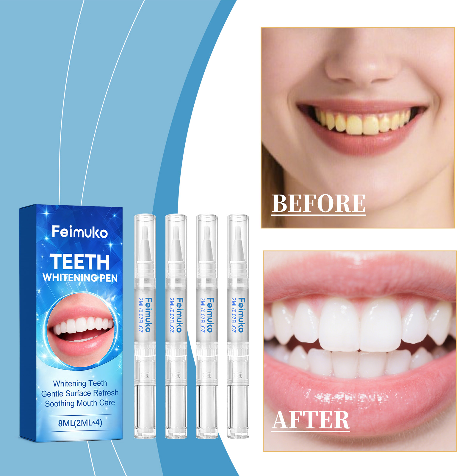 Feimuko 8ml Teeth Gel Pen Gent - Teeth Whitening From Home ulasan dan harga