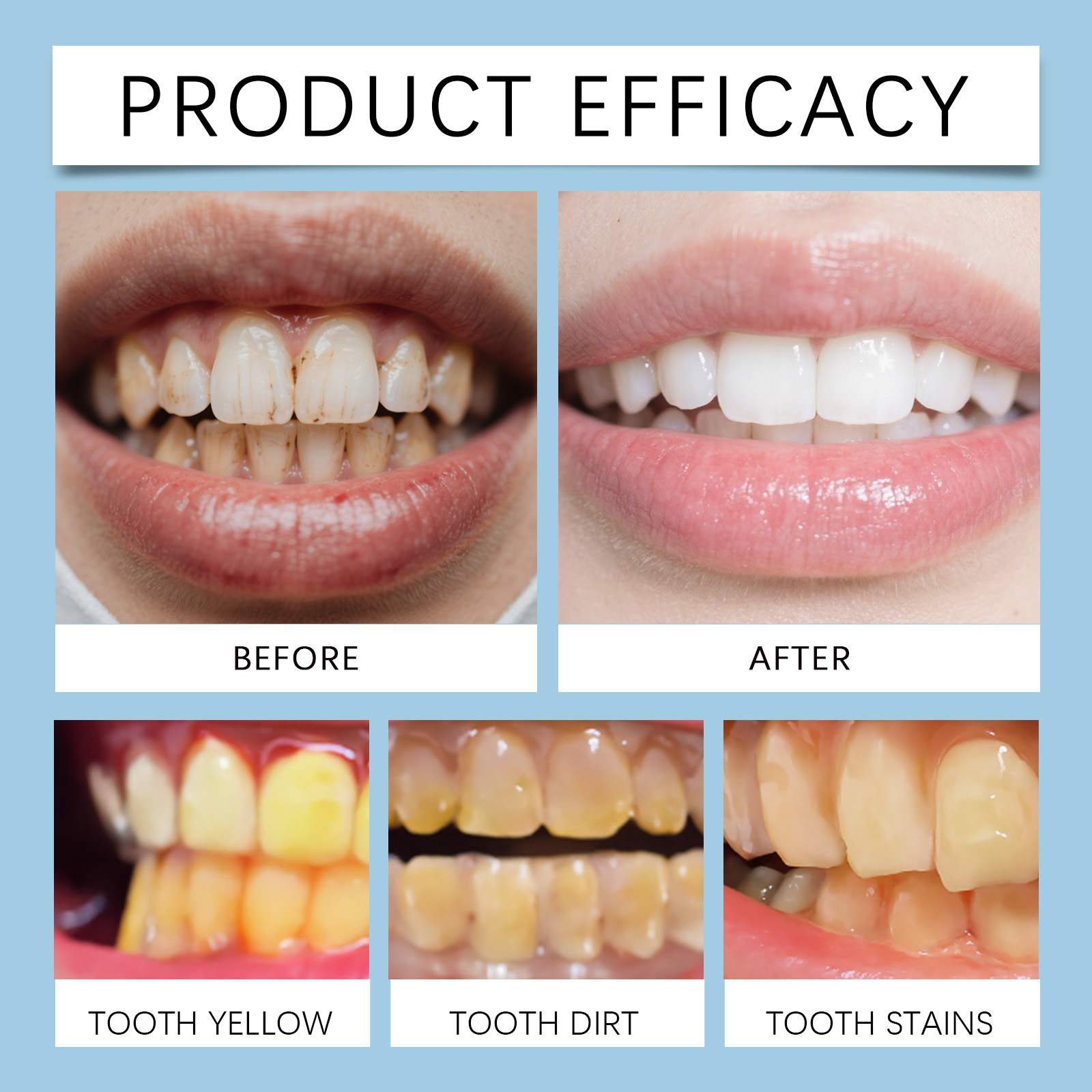 Feimuko 8ml Teeth Gel Pen Gent - Teeth Whitening From Home ulasan dan harga