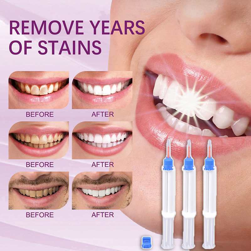 Dental Clinic Dual Barrier Syr - Teeth Whitening Gel Peroxide ulasan dan harga
