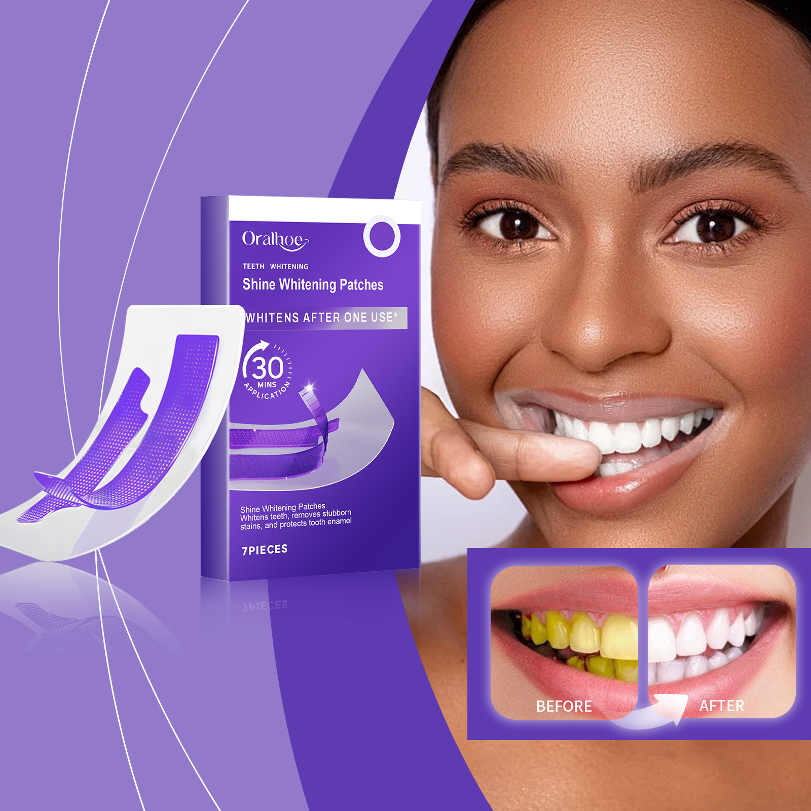 Purple Teeth Whitening Strips  - Teeth Whitening Retainer ulasan dan harga