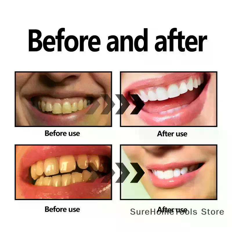 Bamboo Charcoal Powder For Tee - Teeth Whitening From Home ulasan dan harga