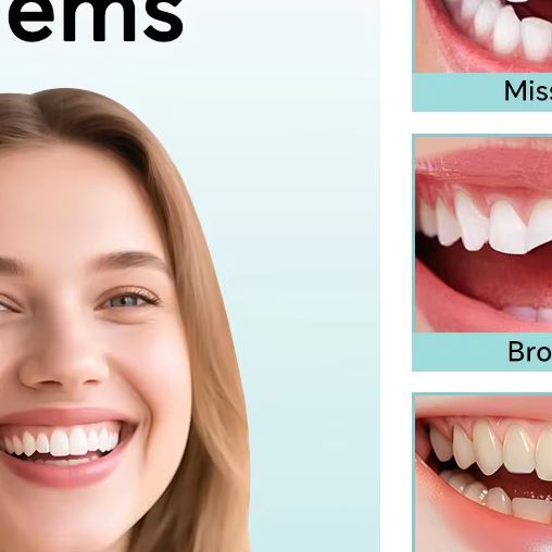 Temporary Denture Silicone Rel - Teeth Whitening Uv Kit ulasan dan harga