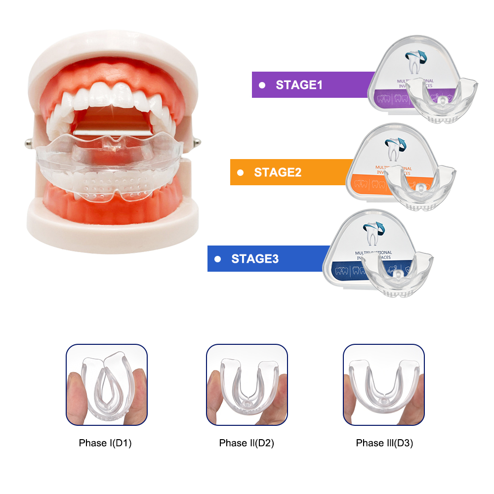 3 Stages Dental Braces Teeth T - Teeth Whitening Uv Kit ulasan dan harga