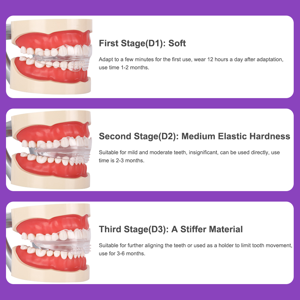3 Stages Dental Braces Teeth T - Teeth Whitening Uv Kit ulasan dan harga