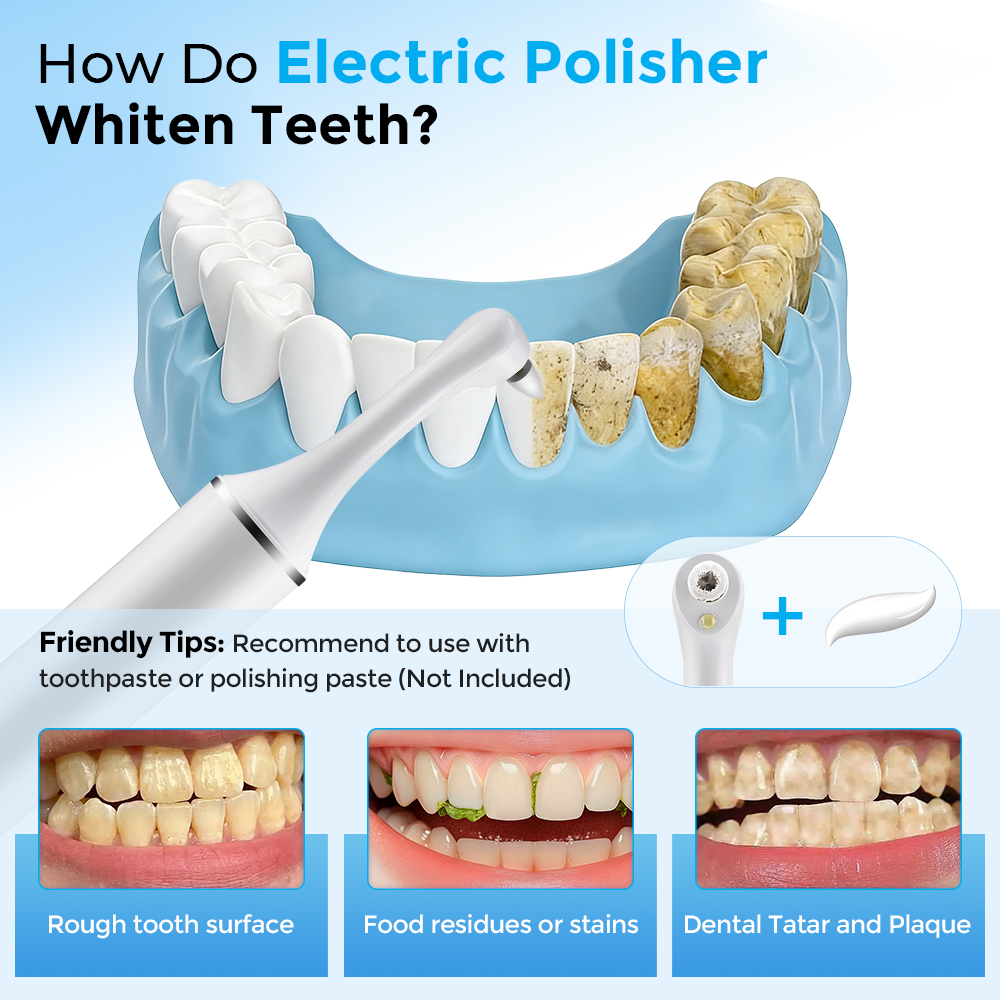 Electric Tooth Polisher Teeth  - Teeth Whitening Led ulasan dan harga