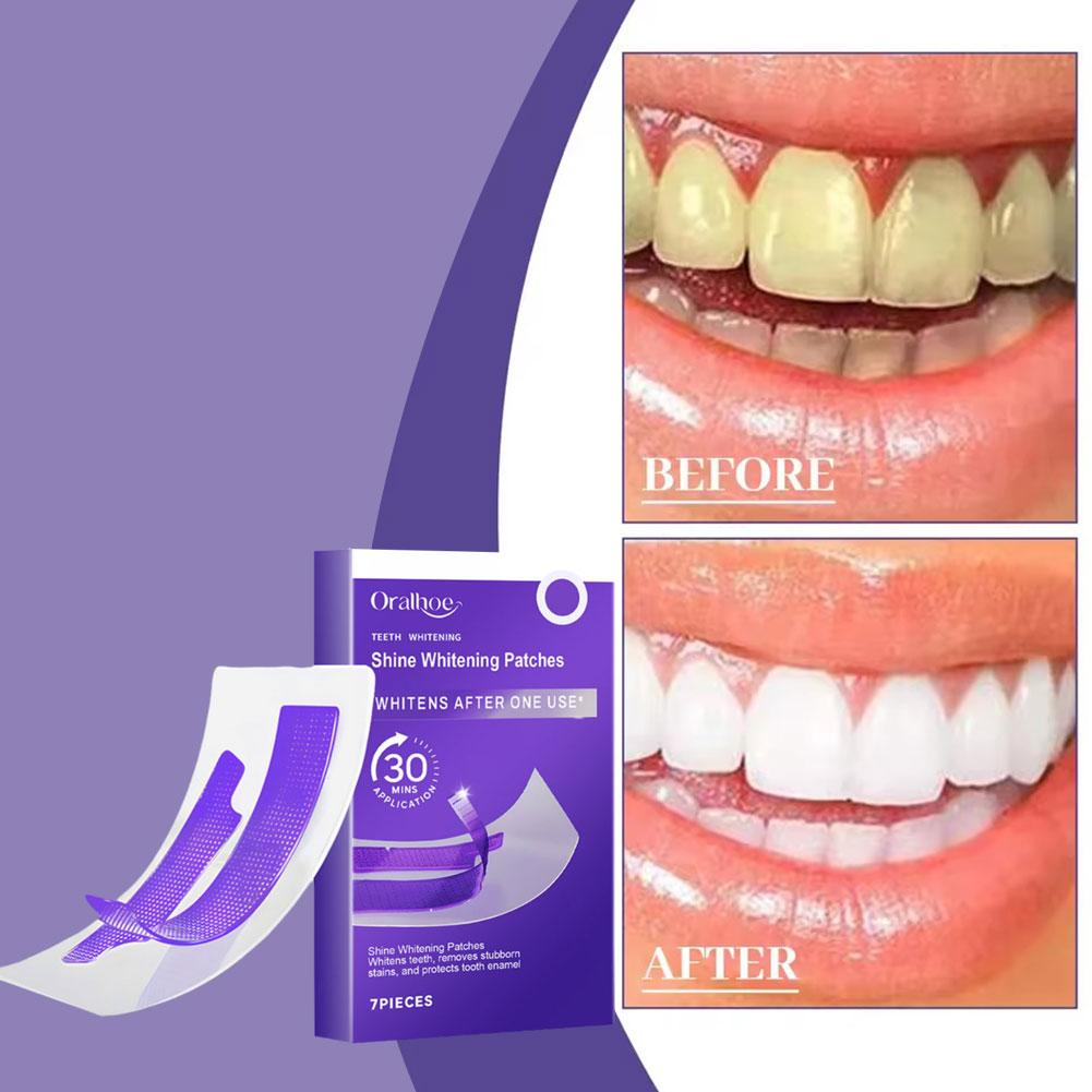 Purple Teeth Whitening Strips  - Teeth Whitening Retainer ulasan dan harga