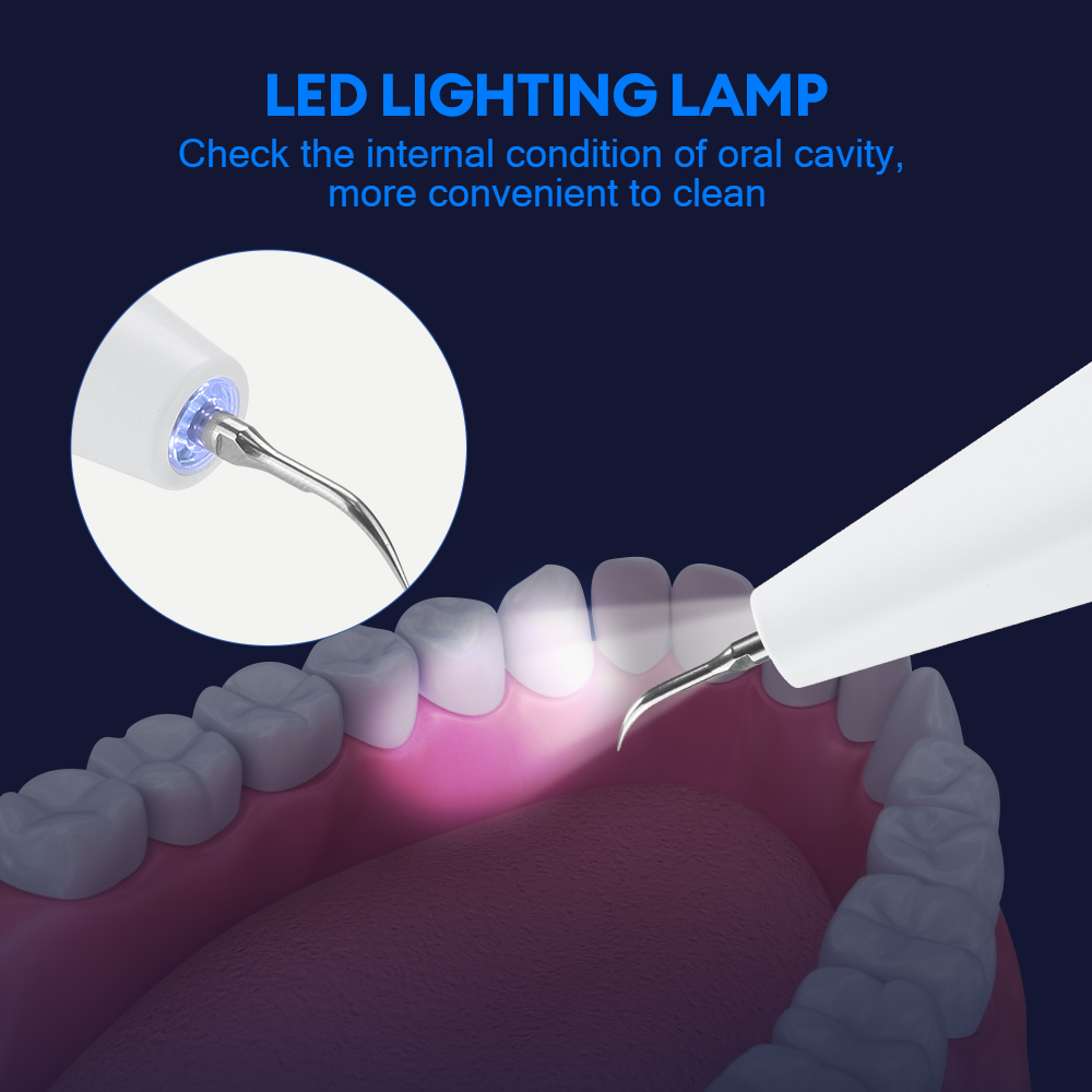 Ultrasonic Dental Calculus Rem - Teeth Whitening Express ulasan dan harga