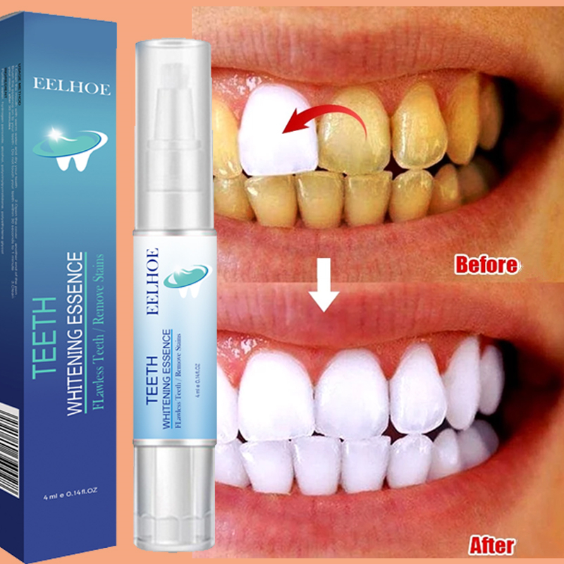 Teeth Whitening Pen Dental Ess - Whitening Pen Bleach ulasan dan harga