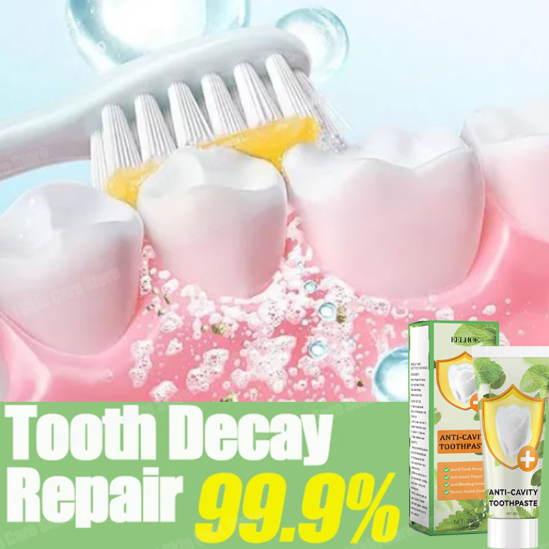 Anti Decay Toothpaste repairs  - Teeth Whitening Cream ulasan dan harga