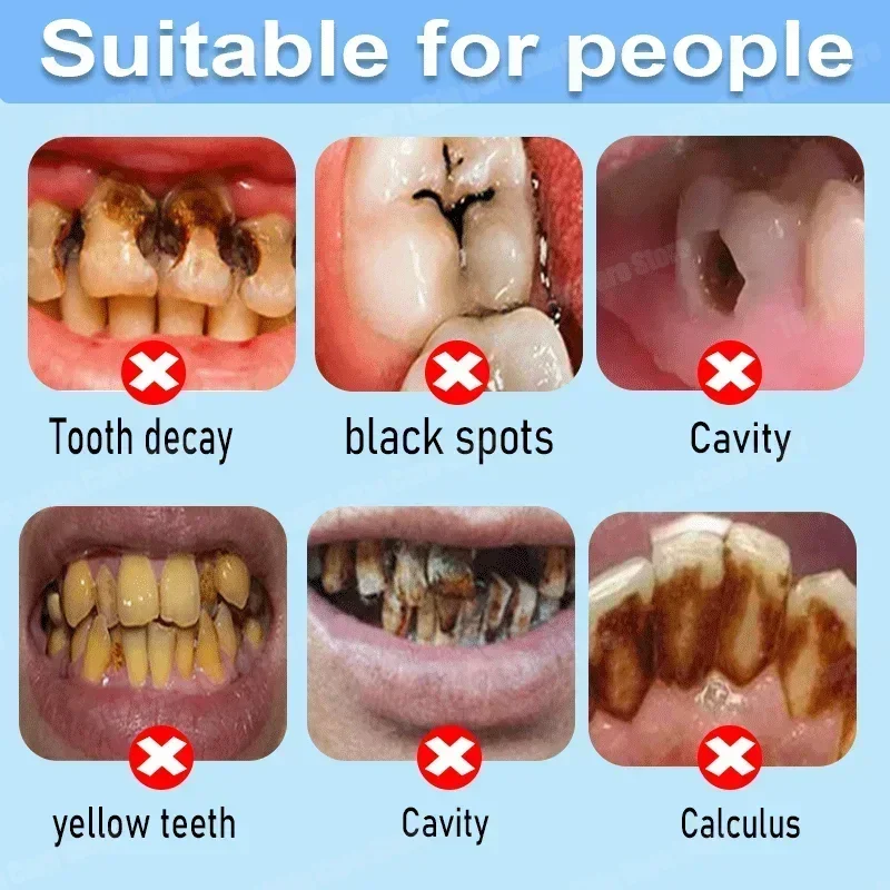 Anti Decay Toothpaste repairs  - Teeth Whitening Cream ulasan dan harga