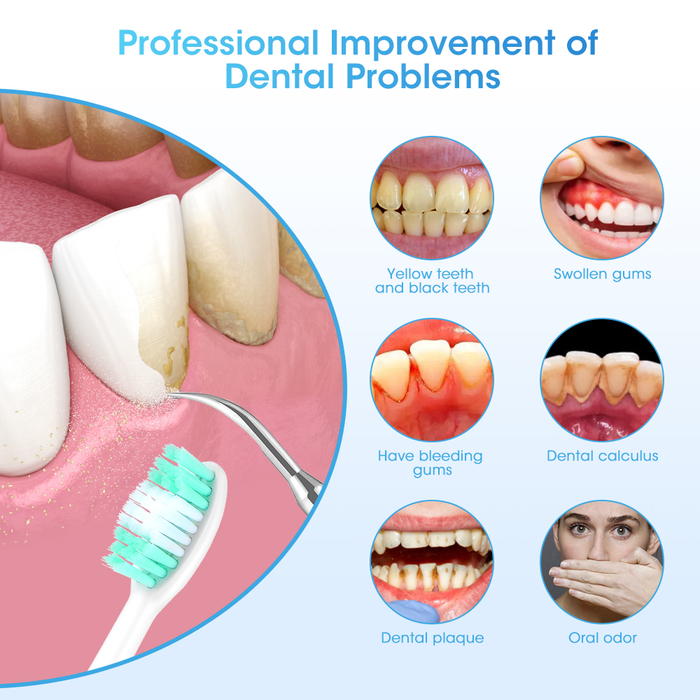 Electric Sonic Dental Calculus - Teeth Whitening And Stain Removal ulasan dan harga