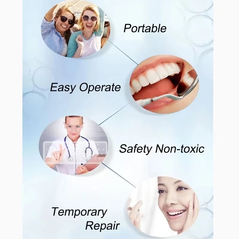 Permanent Dental Teeth Glue Ce - Teeth Whitening Uv Kit ulasan dan harga