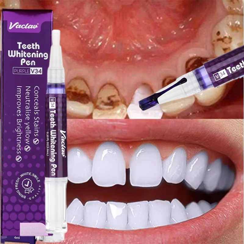 V34 Teeth Whtening Pen Toothpa - Whitening Pen Bleach ulasan dan harga