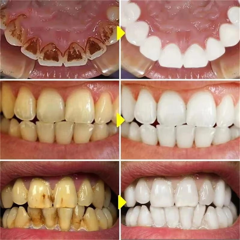 V34 Teeth Whtening Pen Toothpa - Whitening Pen Bleach ulasan dan harga