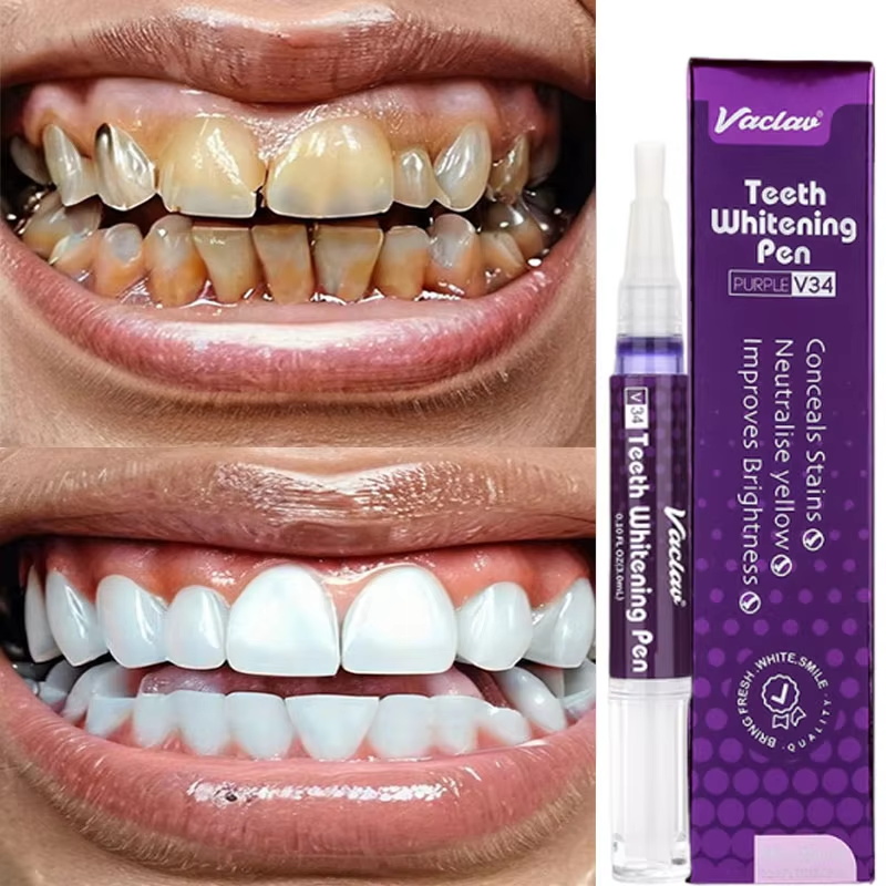 V34 Teeth Whtening Pen Toothpa - Whitening Pen Bleach ulasan dan harga
