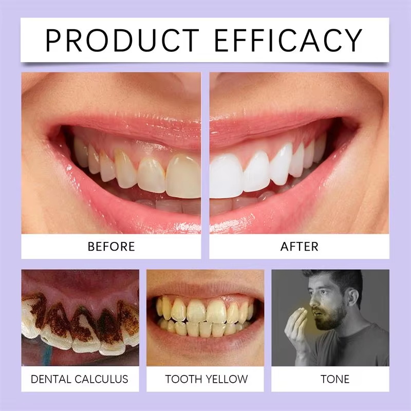 V34 Teeth Whtening Pen Toothpa - Whitening Pen Bleach ulasan dan harga