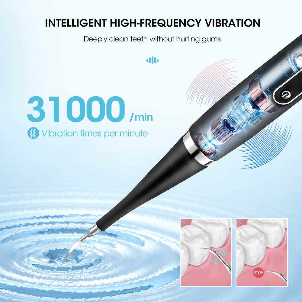 Portable Electric Sonic Dental - Teeth Whitening And Stain Removal ulasan dan harga