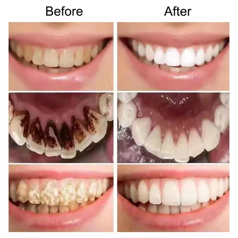7.5% Hydroxyapatite Probiotic  - Teeth Whitening Cream ulasan dan harga