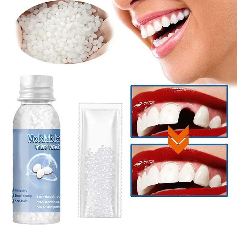 Temporary Tooth Repair Kit Tee - Teeth Whitening Uv Kit ulasan dan harga