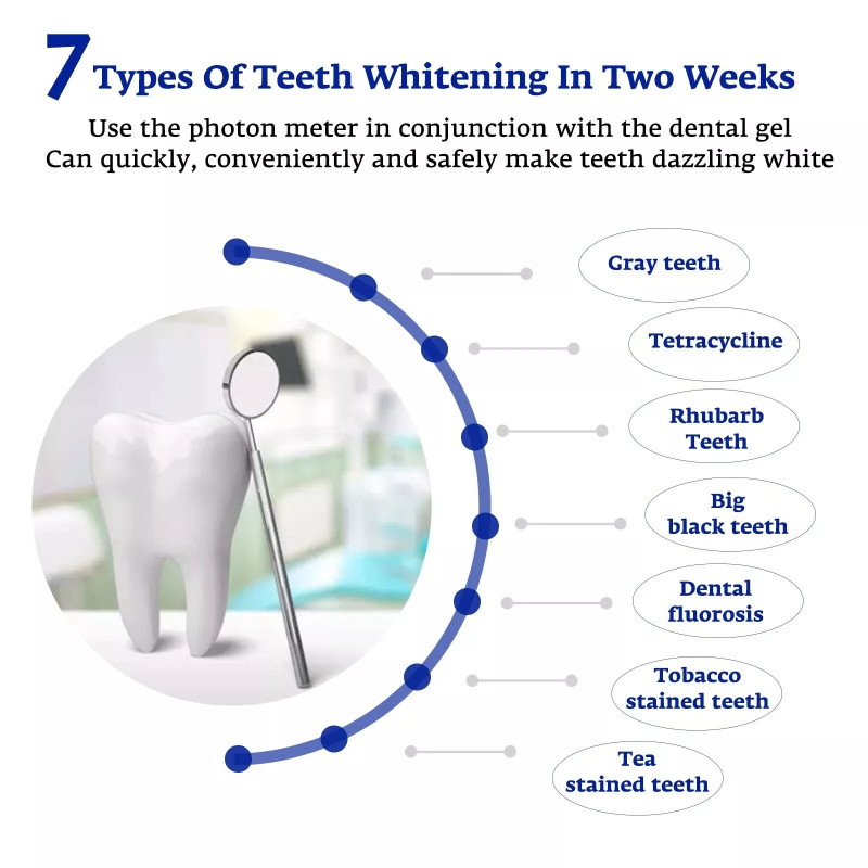 Teeth Whitening Accelerator Sm - Teeth Whitening Uv Kit ulasan dan harga