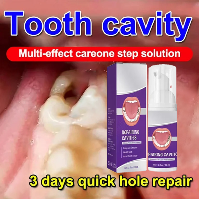 Teeth Cleaning Toothpaste Remo - Teeth Whitening Cream ulasan dan harga