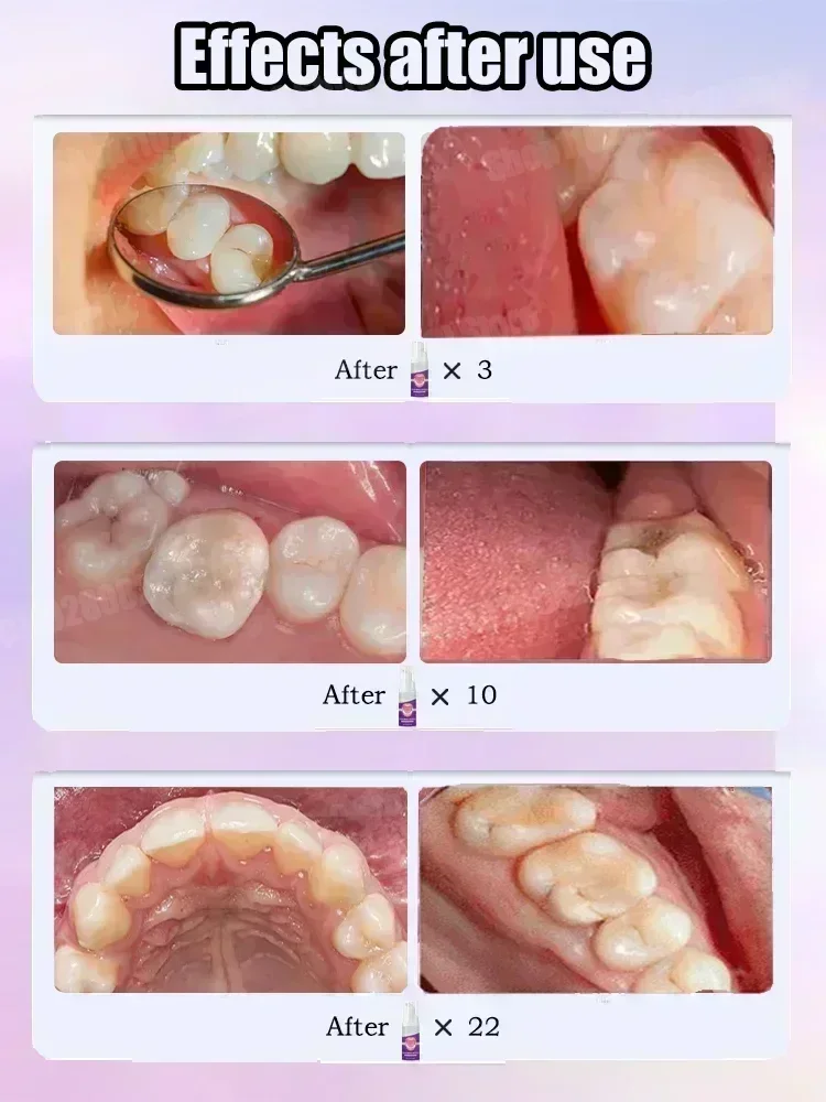 Teeth Cleaning Toothpaste Remo - Teeth Whitening Cream ulasan dan harga