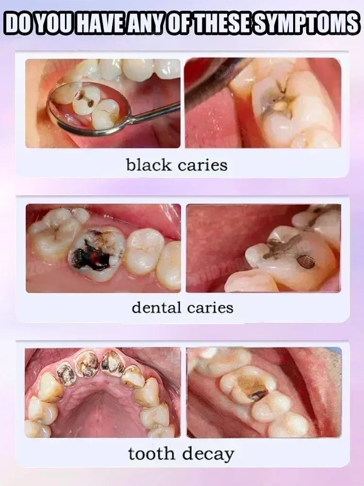 Teeth Cleaning Toothpaste Remo - Teeth Whitening Cream ulasan dan harga