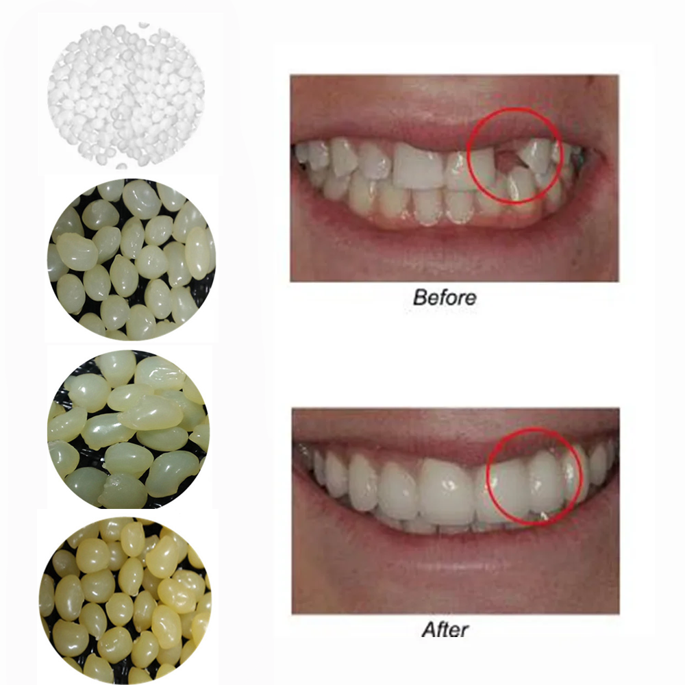 4 Colors Dental Oral False Fak - Teeth Whitening Uv Kit ulasan dan harga