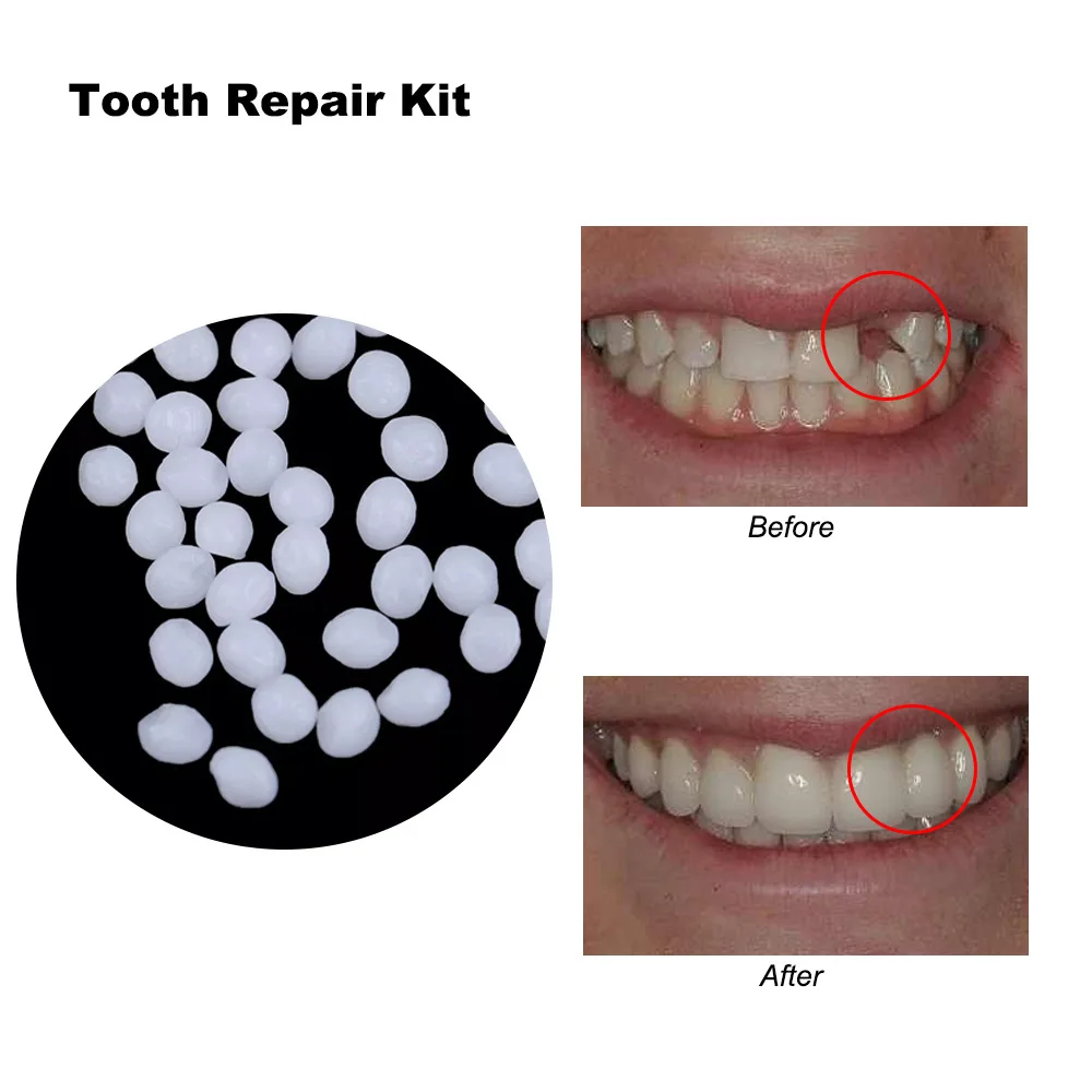 4 Colors Dental Oral False Fak - Teeth Whitening Uv Kit ulasan dan harga