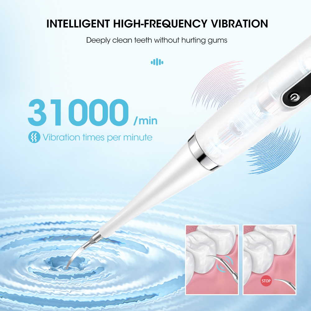 Electric Sonic Dental Calculus - Teeth Whitening And Stain Removal ulasan dan harga