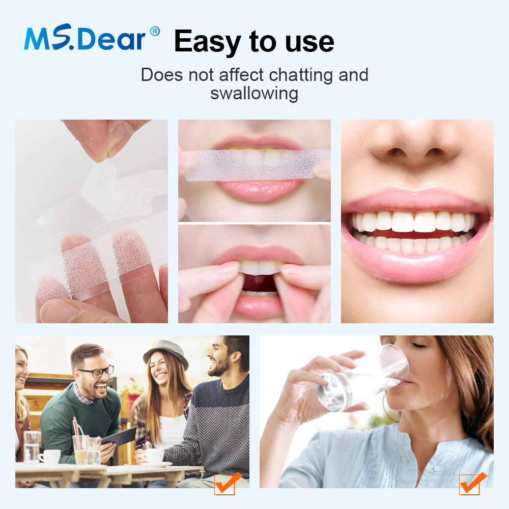 Teeth Whitening Strips Cleansi - Teeth Whitening From Home ulasan dan harga